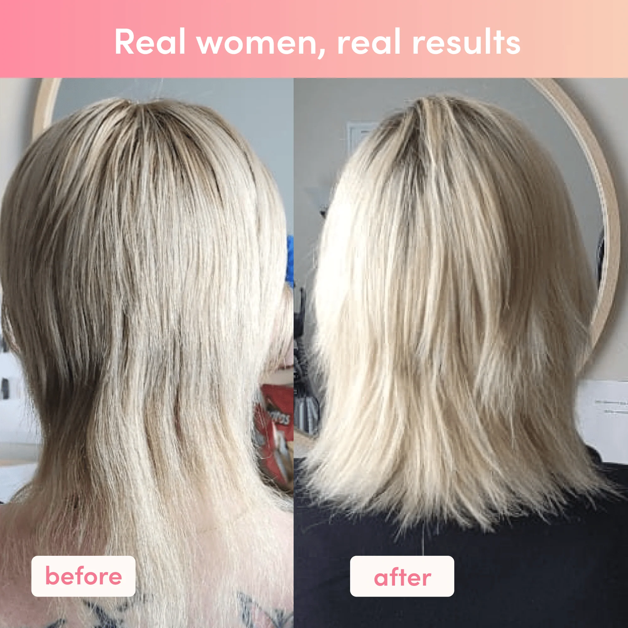 Beauty Boost Bundle - Image 5