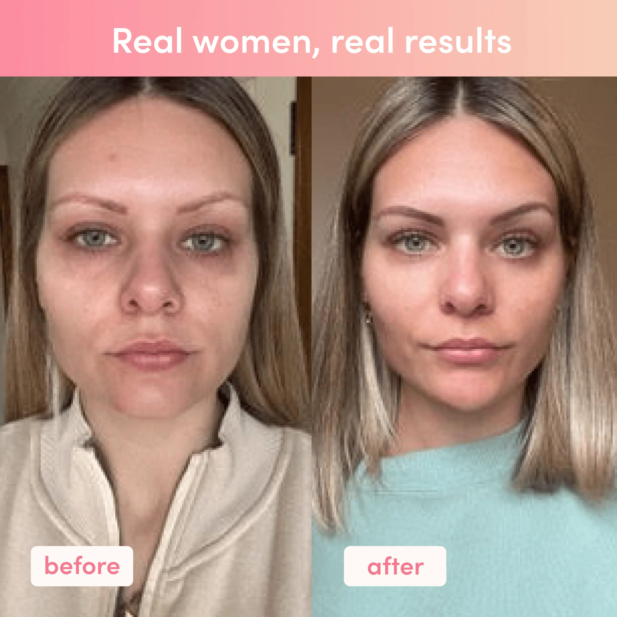 Beauty Boost Bundle - Image 8
